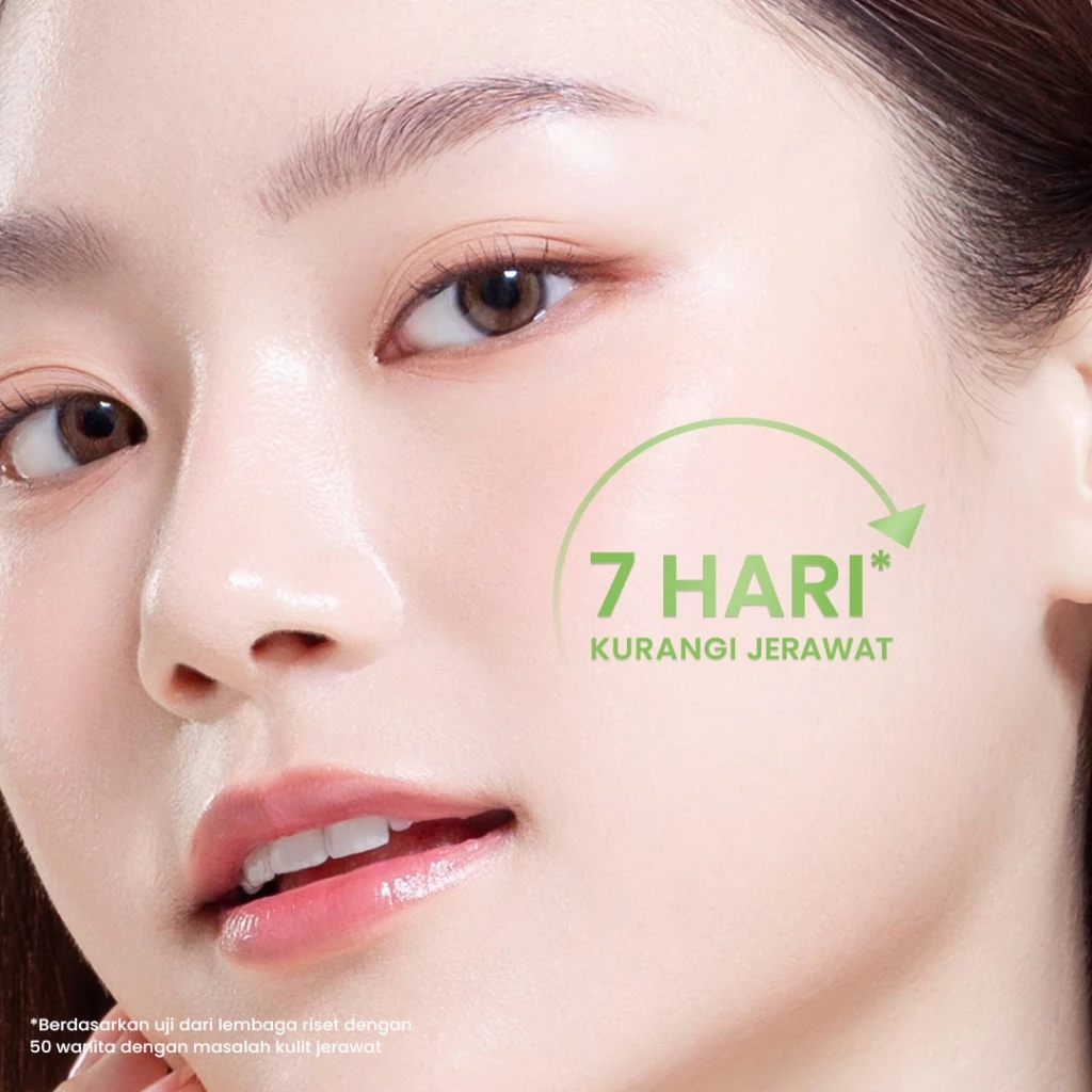 Jual Hanasui - Acne Expert Series - Mengurangi Jerawat Menenangkan ...