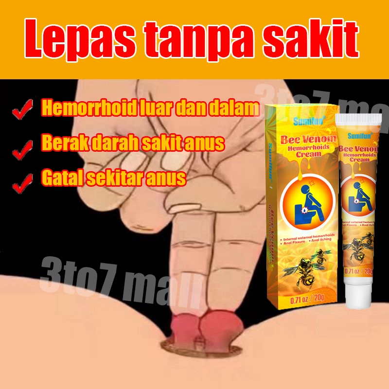 salep ambeien paling ampuh obat wasir salep wasir Tipe campuran Tipe bola daging Aman dan tak menyakitkan untuk menghilangkan ambeien Wasir internal dan eksternal
