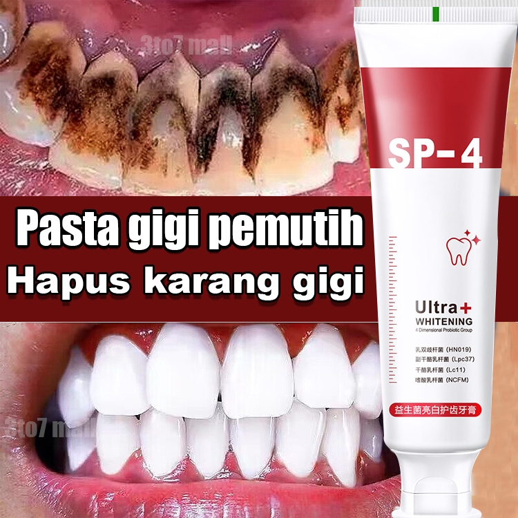 Jual Pasta Gigi Pemutih penghilang karang gigi memutihkan gigi pasta