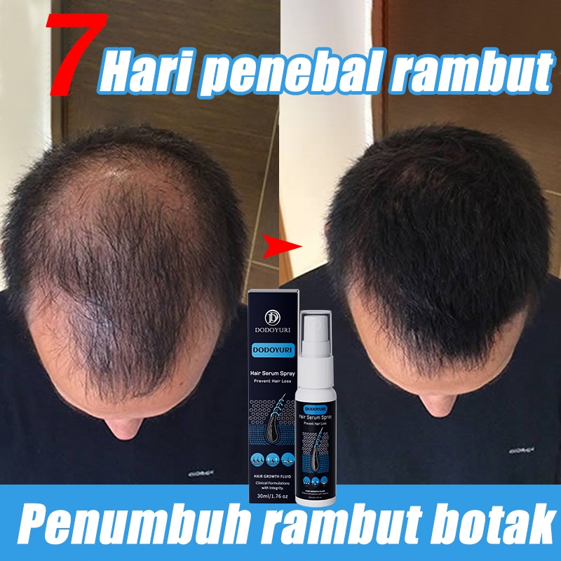 Jual Obat Penumbuh Rambut Minyak Penumbuh Rambut Cepat Serum Penumbuh ...