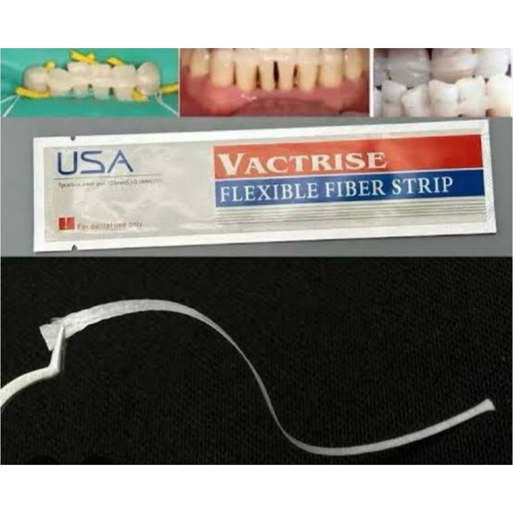 Jual Dental Fiber Splinting splint strip Flexible USA | Shopee Indonesia