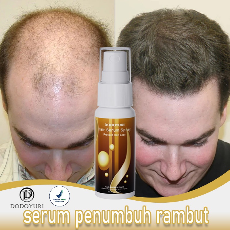 Jual 【BPOM】penumbuh rambut serum penumbuh rambut hair tonic rambut ...