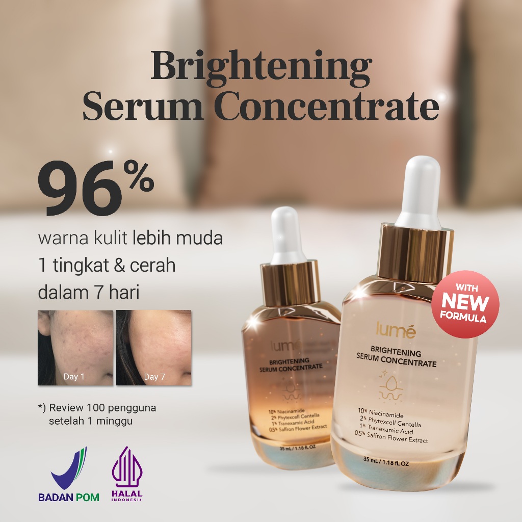 LUME Brightening Serum Concentrate | Niacinamide + Tranexamic Acid | Serum Pencerah Wajah, Bantu Samarkan Bekas Jerawat, Noda Hitam, Kulit Kusam, Glowing