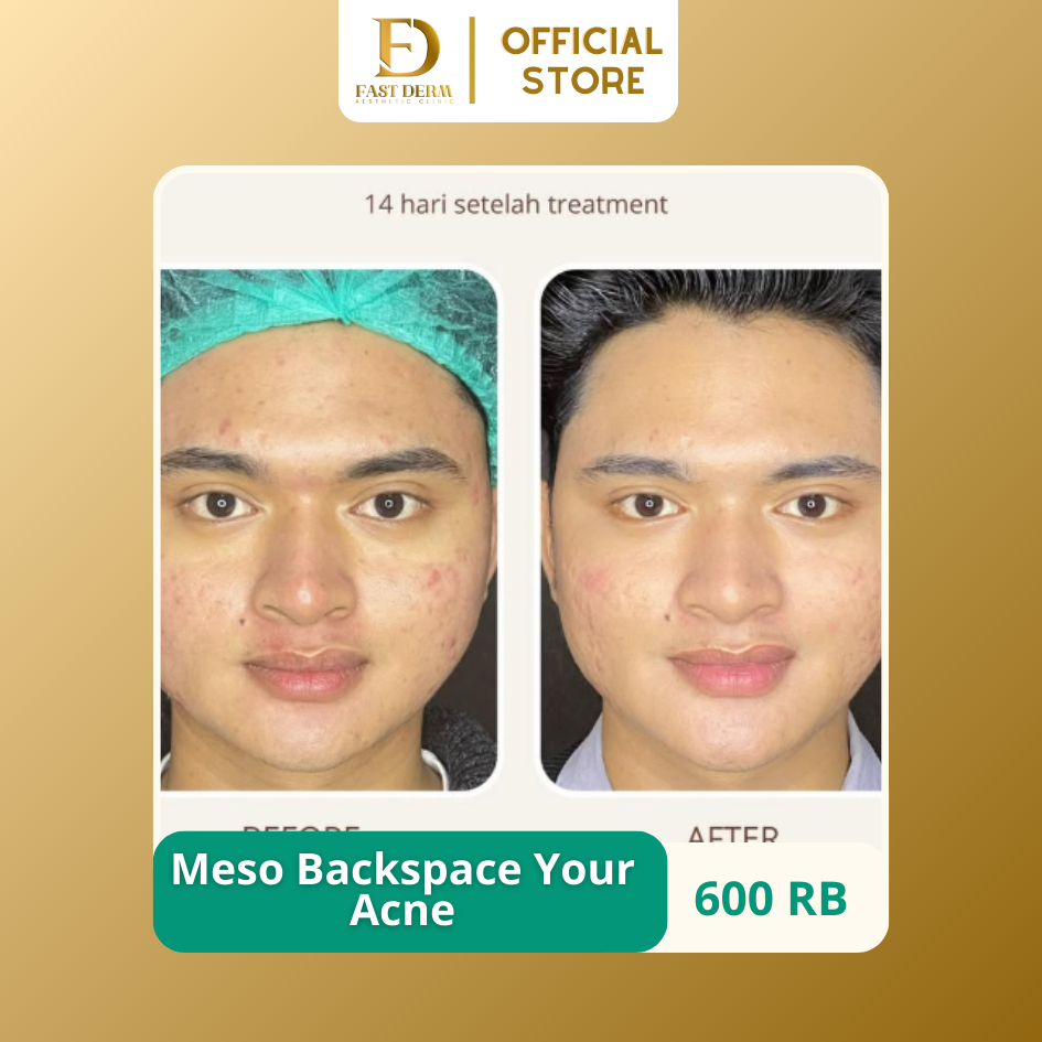 Produk Fast Derm Aesthetic Clinic | Shopee Indonesia