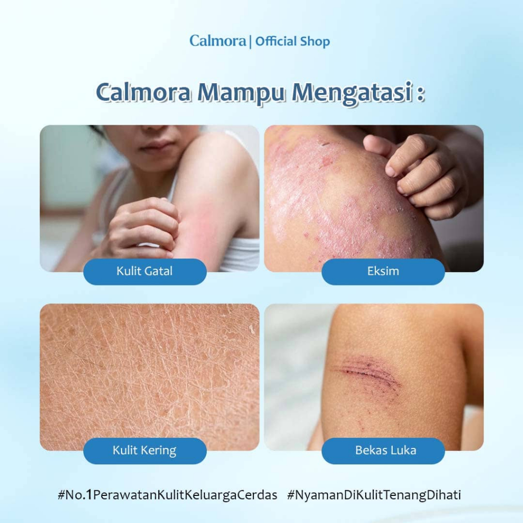 Jual Calmora Calendula Skin Savior Hydrating Balm Salve Untuk Eksim ...