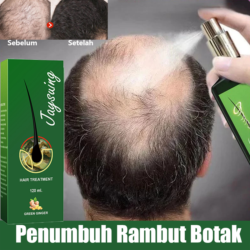 Jual Serum Penumbuh Rambut Cepat Dan Tebal Semprotan Penumbuh Rambut ...