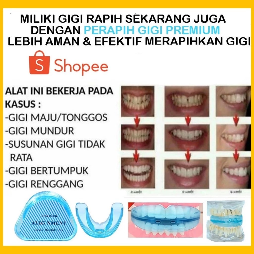 Jual Teeth Trainer Alignment Retainer Perapi Gigi Perapih Gigi Original ...