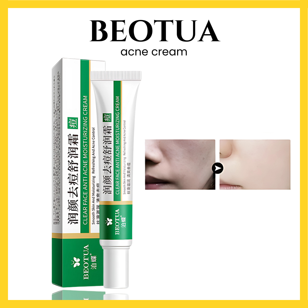Jual BEOTUA Clear Face Anti Acne Moisturizing Cream 20gr Salep Obat ...