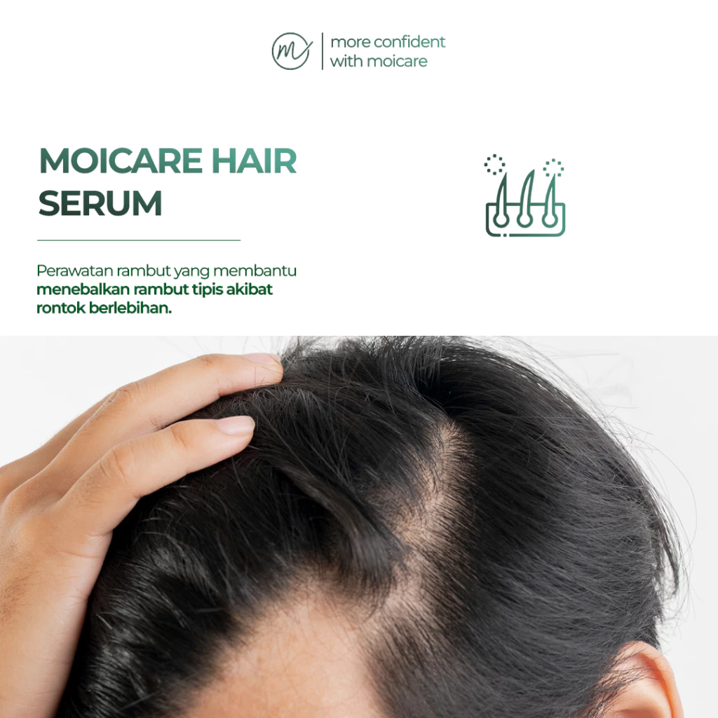 Masalah Rambut