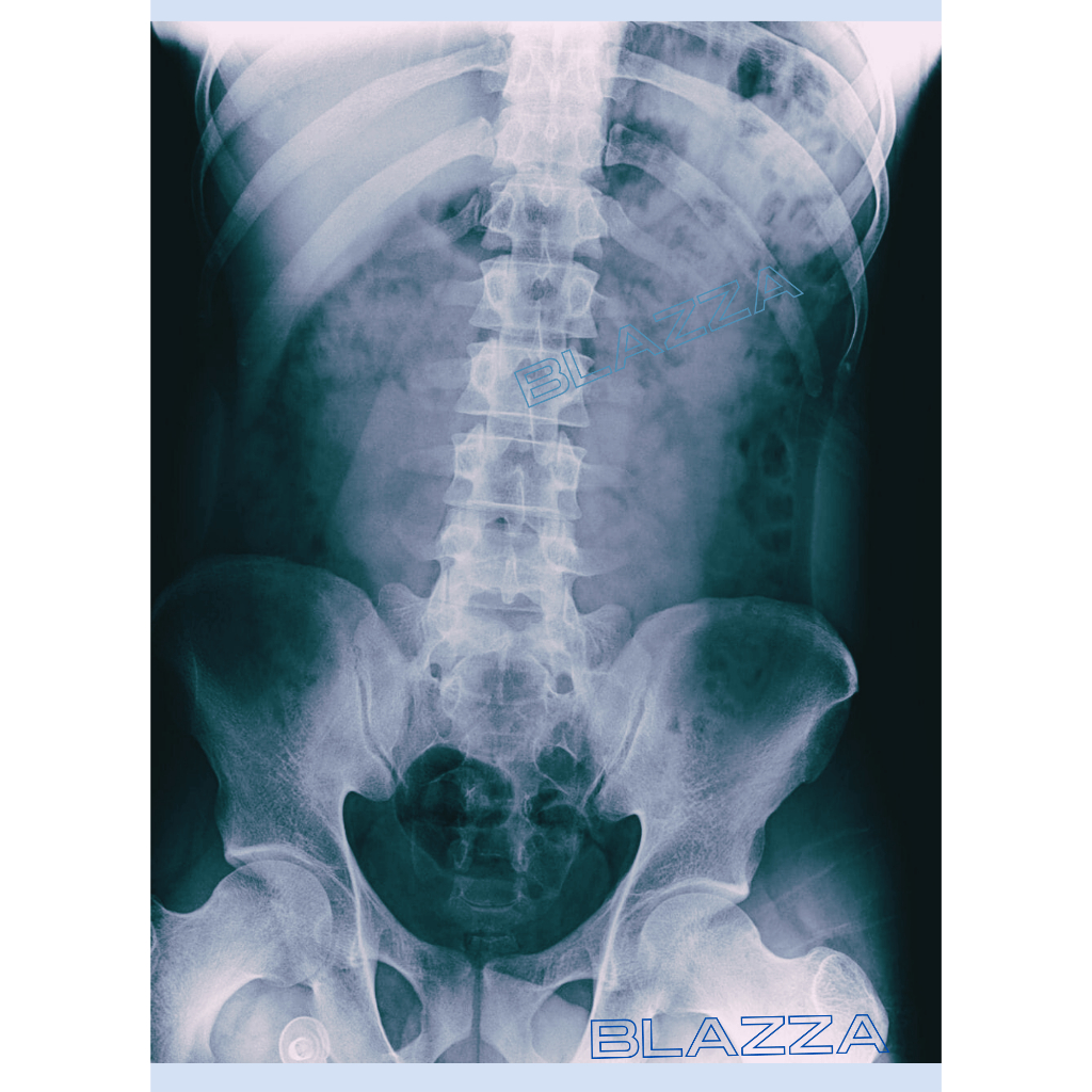 Jual Cetak Foto Image Medical Radiologi Rontgen X-ray CT-scan | Dry ...