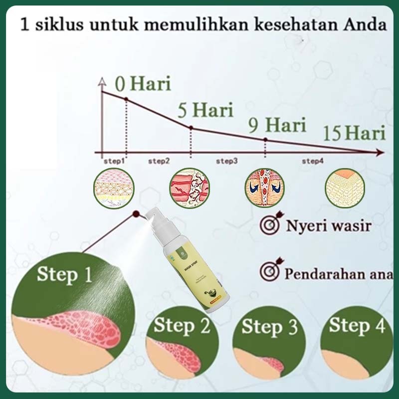 Obat wasir semprot salep ambeien paling ampuh obat ambien salep ambeyen paling ampuh original 30ml salep wasir ampuh asli china Tipe campuran Tipe bola daging Aman dan tak menyakitkan penghilangan cepat herbal premium menghilangkan benjolan, wasir dalam