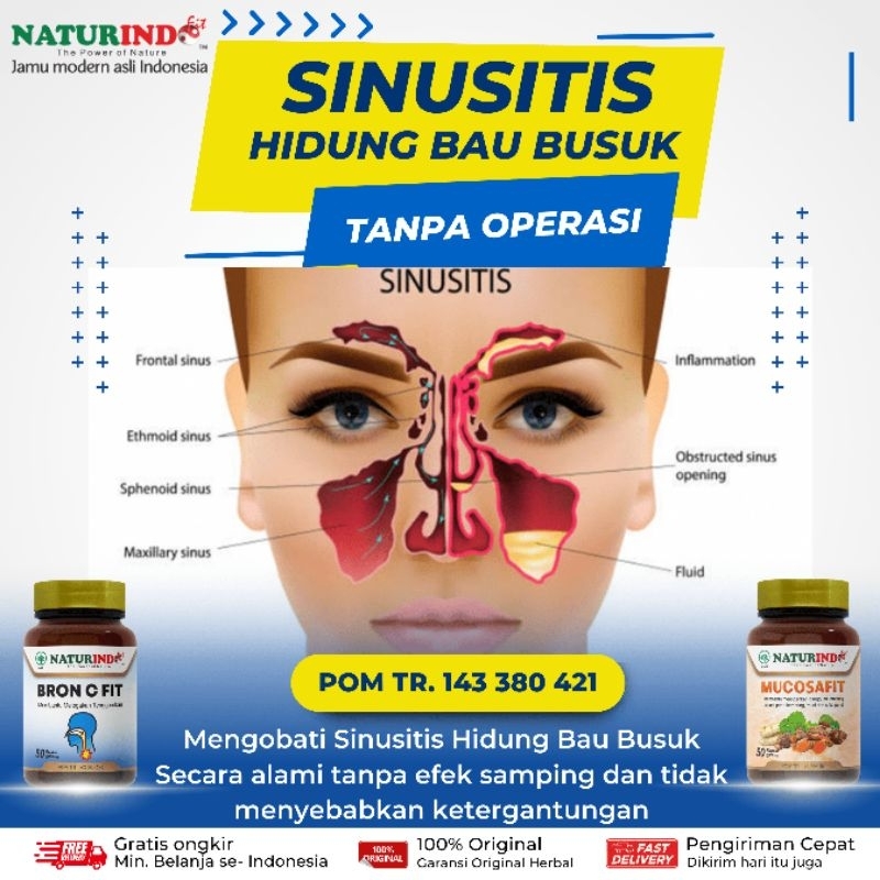 Jual Obat Hidung Bau Busuk Herbal Sinusitis Rinitis Radang Sinus ...