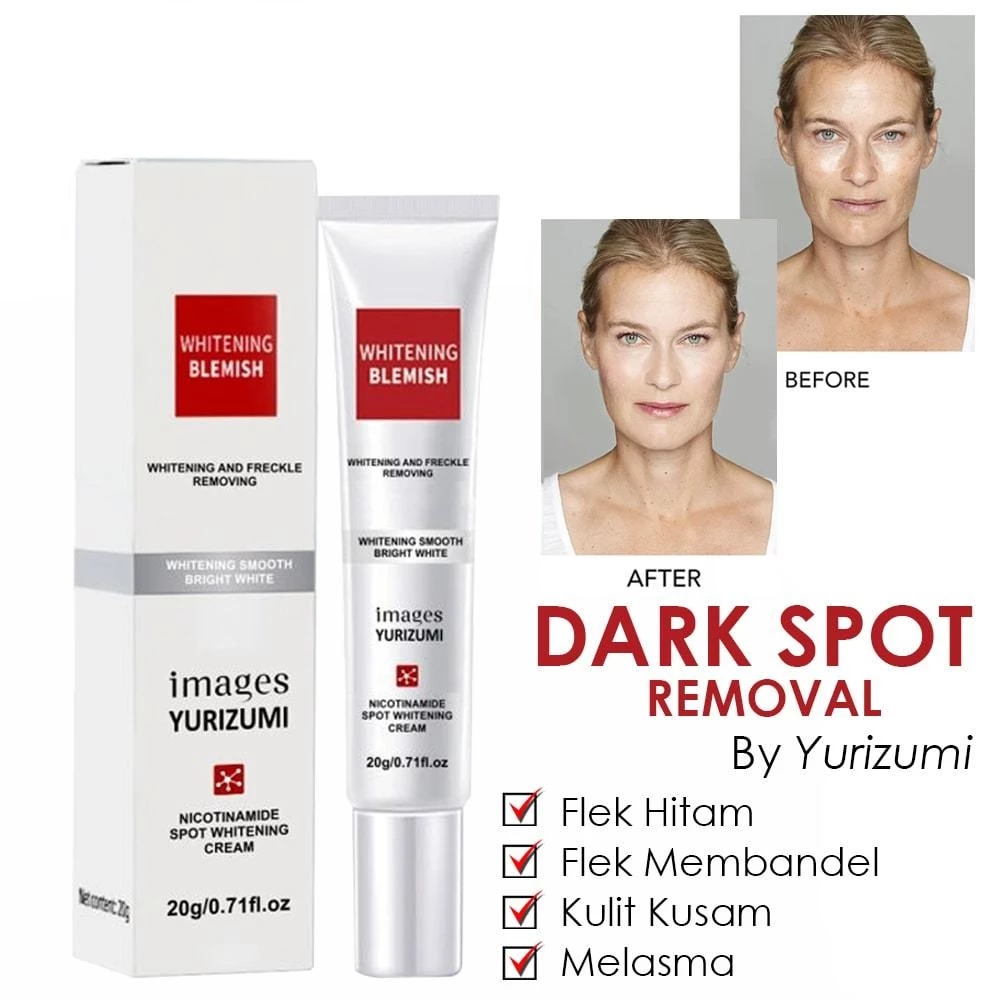 Whitening Freckle Cream Wajah Penghilang Flek Hitam Pada Wajah Pemutih Penghilang Bintik Wajah | AutoStock