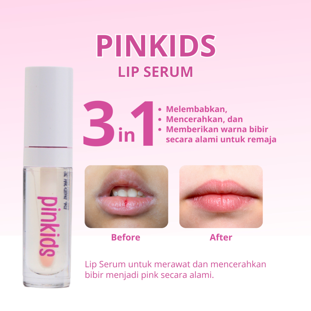 Jual PINKIDS Lips Magic Serum - Bibir Pink Sehat Alami | Shopee Indonesia