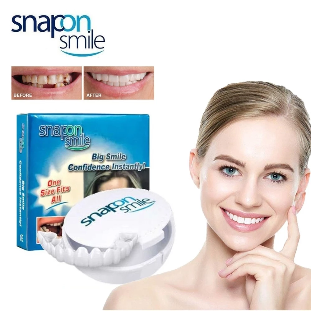 Snap One Smile Gigi Palsu Lepas Pasang Authentic 1 Set Atas Bawah | AutoStock
