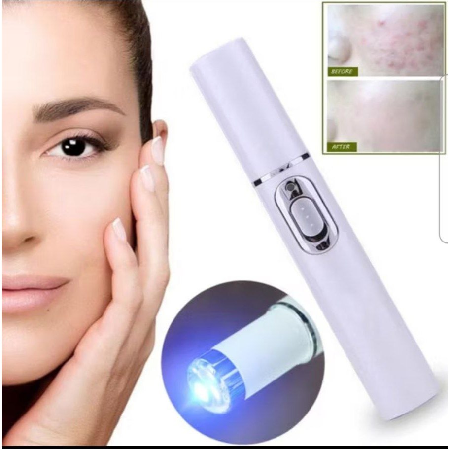 Jual Pena laser penghilang bekas luka cocok untuk bekas jerawat