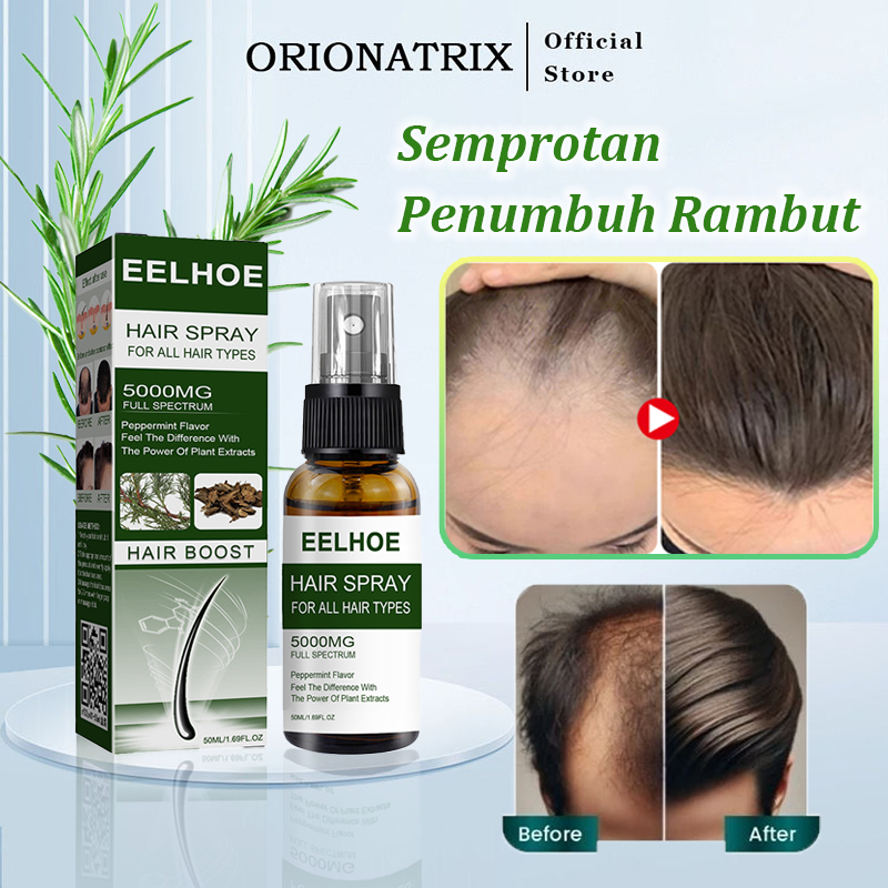 Jual Orionatrix Semprotan Penumbuh Rambut Botak Hair Growth Spray Obat ...