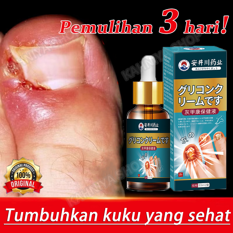 Jual Serum kuku Obat cantengan Obat kuku jamur dan rusak Vitamin kuku