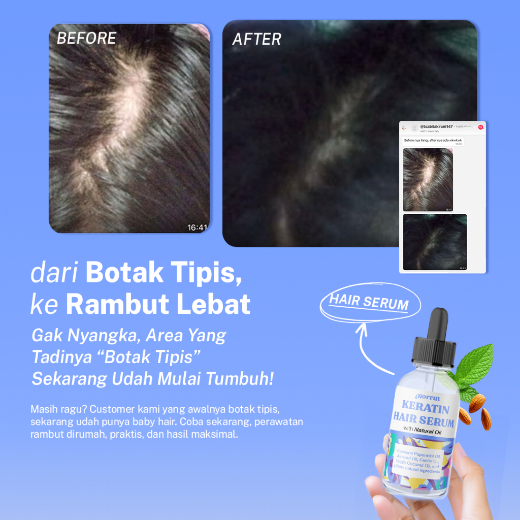 Jual Morrin Keratin Hair Serum Oil – Serum Anti Rontok, Anti Ketombe ...