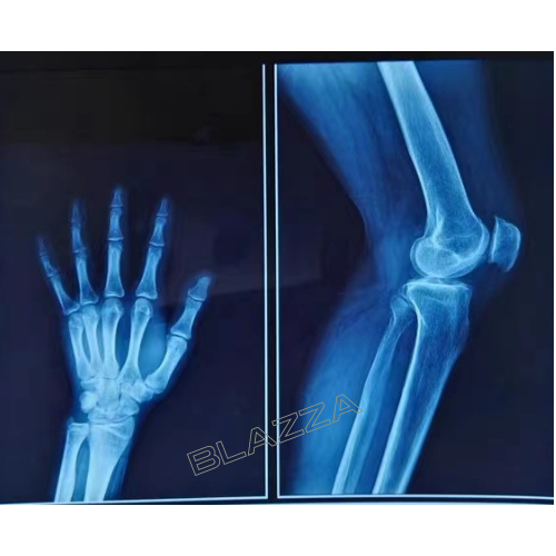 Jual Terima Cetak Film Radiologi Medical Rontgen X-RAY A4 | Shopee ...
