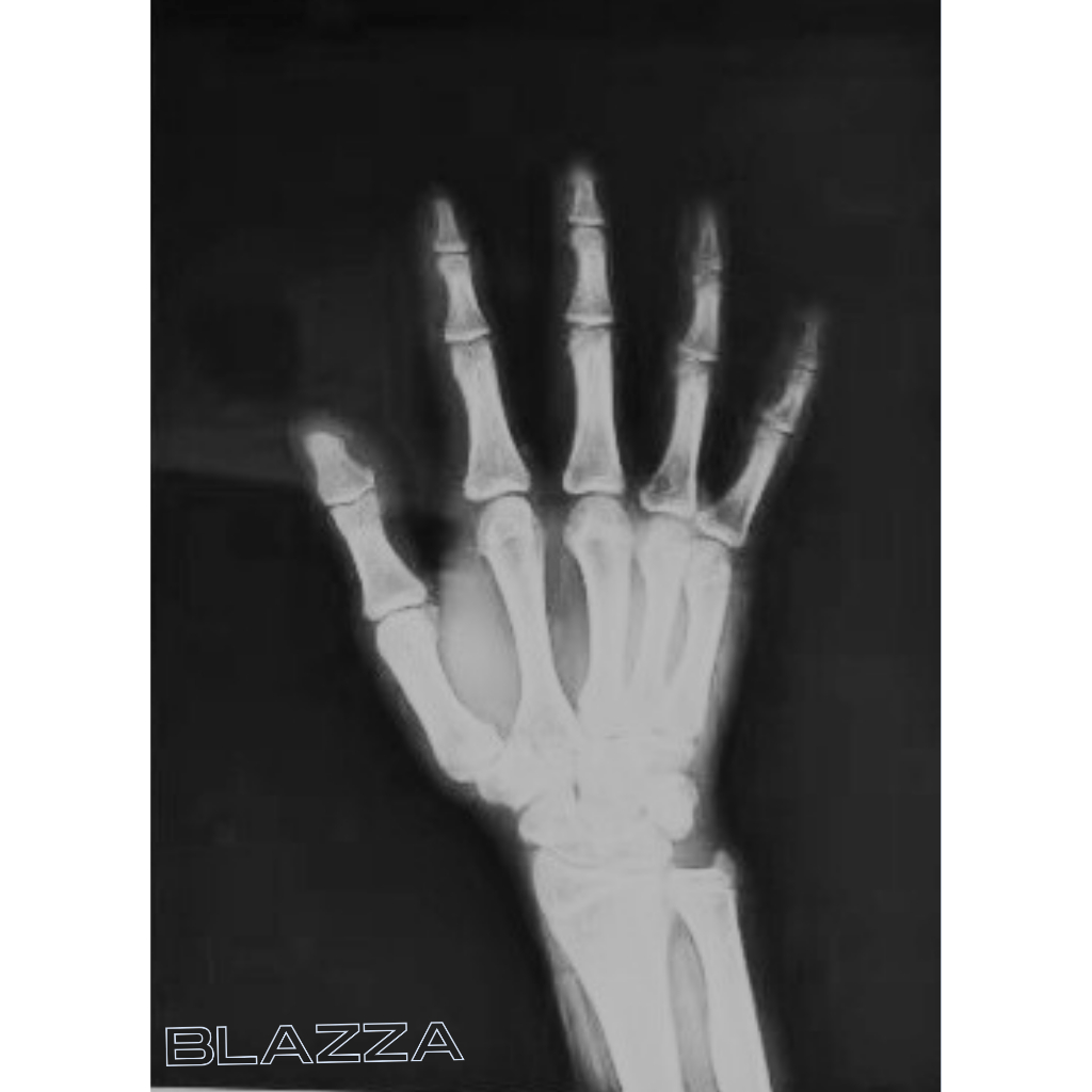 Jual Cetak Foto Image Medical Radiologi Rontgen X-ray CT-scan | Dry ...