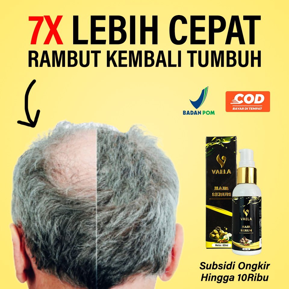 Jual Vaela Hair Serum Penumbuh Rambut Serum Rambut Pencegah Kebotakan ...