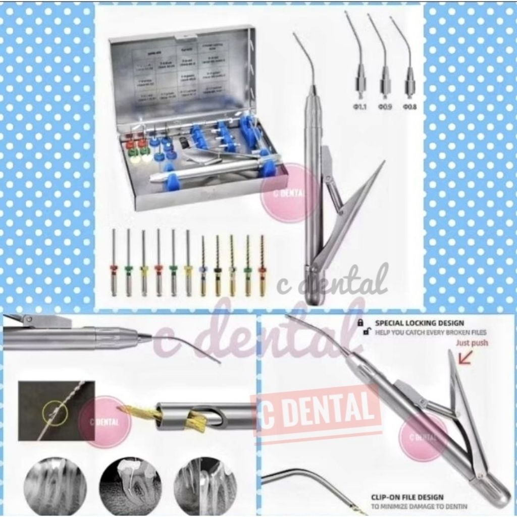 Jual [1 Set] Dental Endo Retriever Removing Broken Separated File (Pen ...