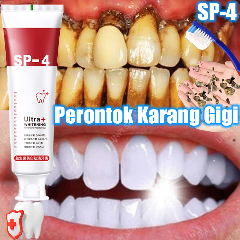 Jual sp 4 pemutih gigi Pasta Gigi Pemutih penghilang karang gigi