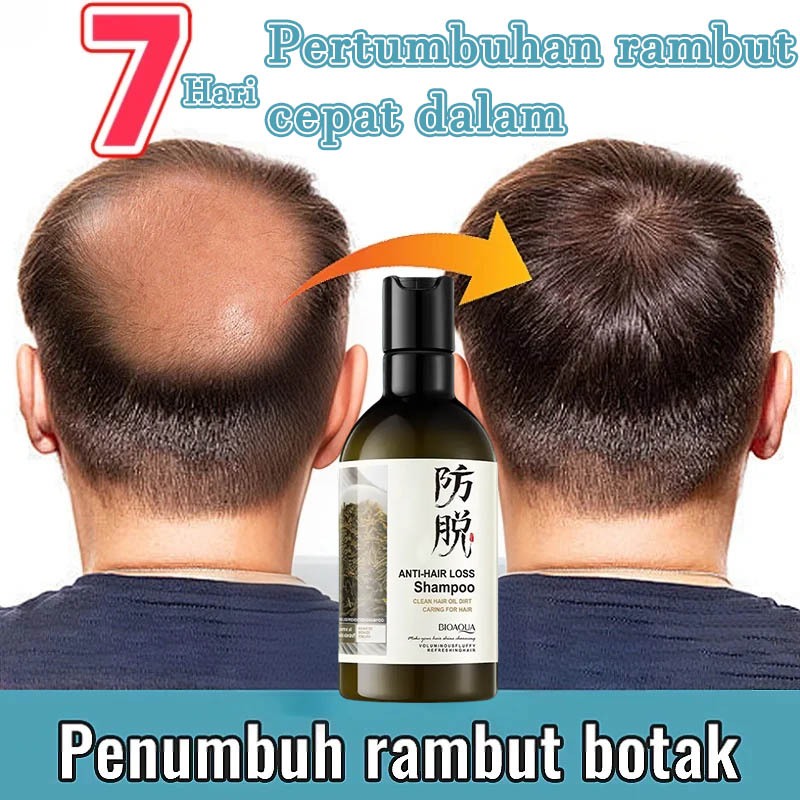 Jual shampoo penumbuh rambut cepat shampoo rambut rontok shampoo anti ...