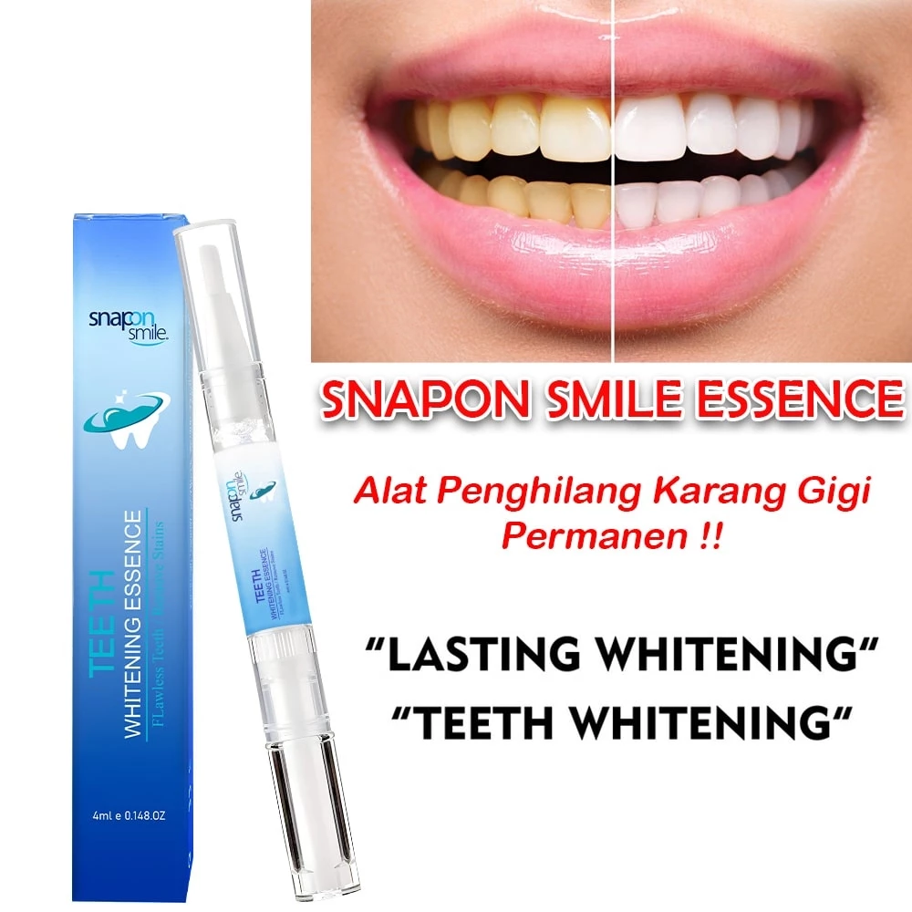 Hope Store - Snap On Smile Peen Pemutih Alami Flawless Teeth / Remove Stains | AutoStock