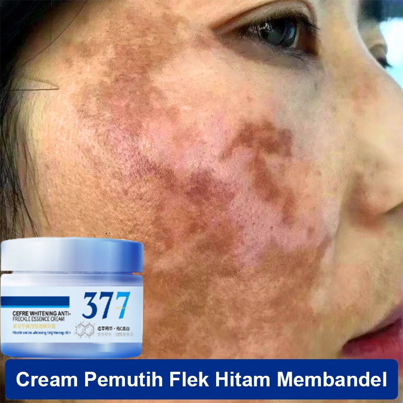 Jual Skincare 377 Terlengkap & Harga Terbaru Agustus 2026 | Shopee ...
