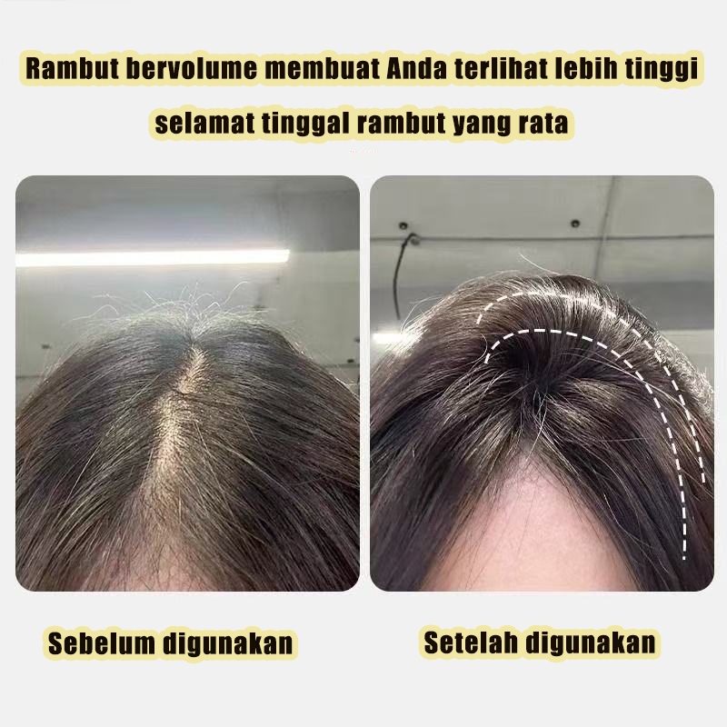 Jual MELEDE KOREAN ROOT HAIR CLIP VOLUMIZER / VOLUME HAIR CLIP/JEPIT ...