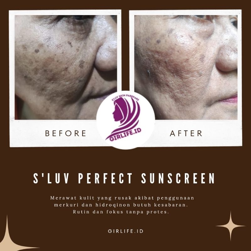 Jual Perfect Sunscreen Sluv (3kg) | Shopee Indonesia