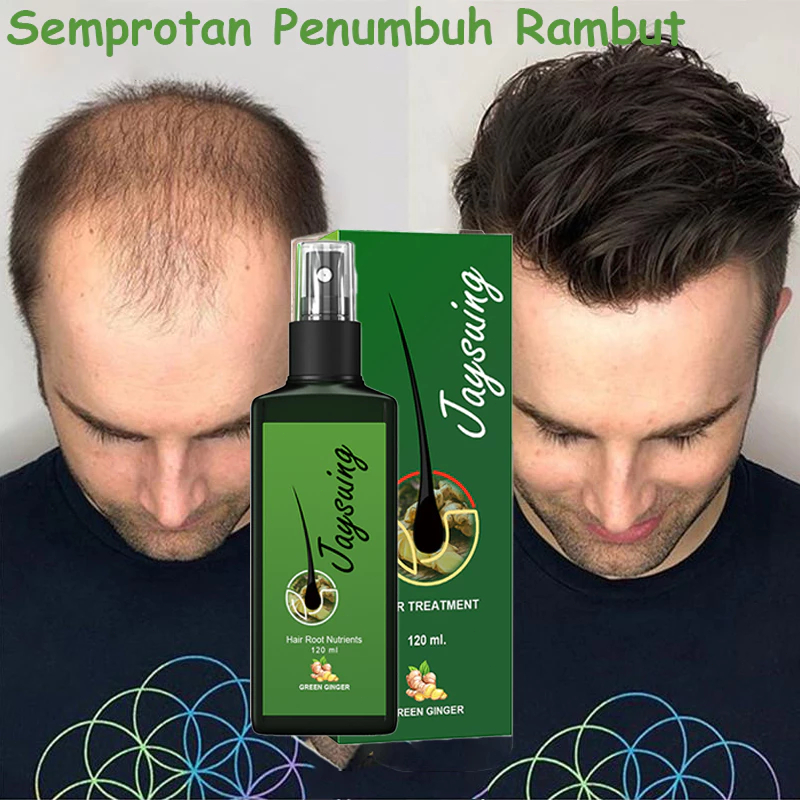 Jual Serum Penumbuh Rambut Cepat Dan Tebal Semprotan Penumbuh Rambut ...