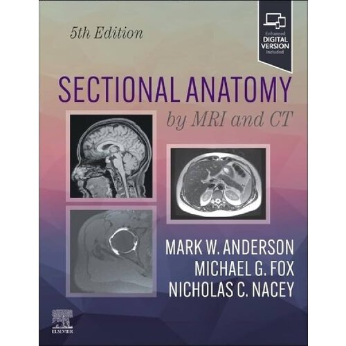 Jual Sectional Imaging by MRI and CT - Radiology Imaging 5th edition ...