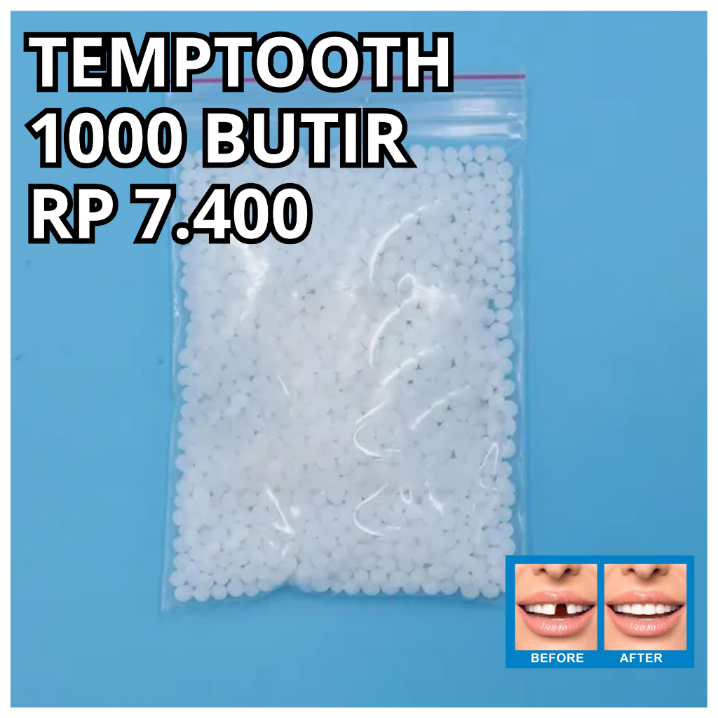 Jual Penambal Gigi 1000 Butir / Temptooth Gigi Palsu isi 1000 Butir ...