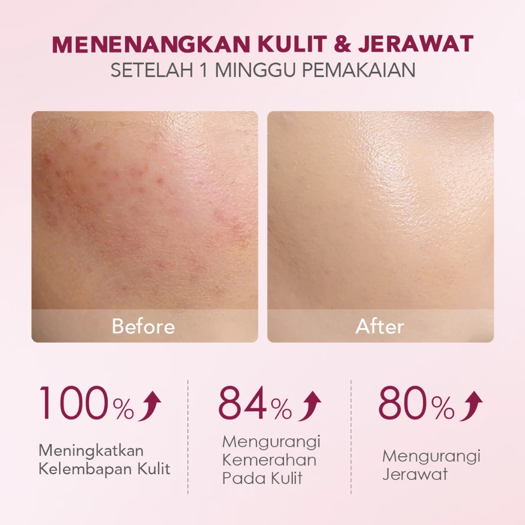 Hyalucera Gel Pelembab Wajah dan Primer Menghidrasi Skin Barrier Originote