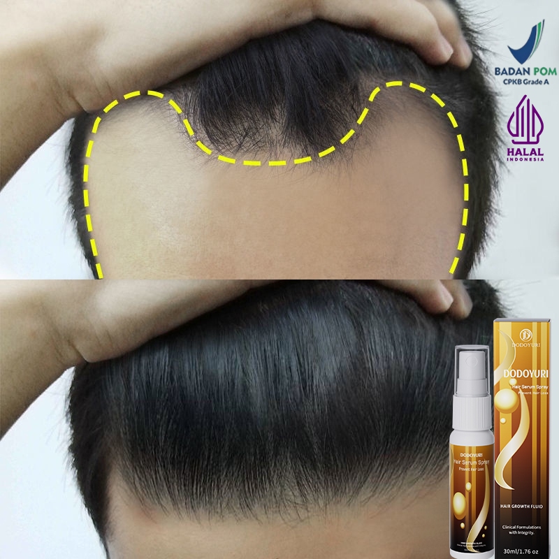 Jual Serum penumbuh rambut penumbuh rambut botak penebal rambut ...