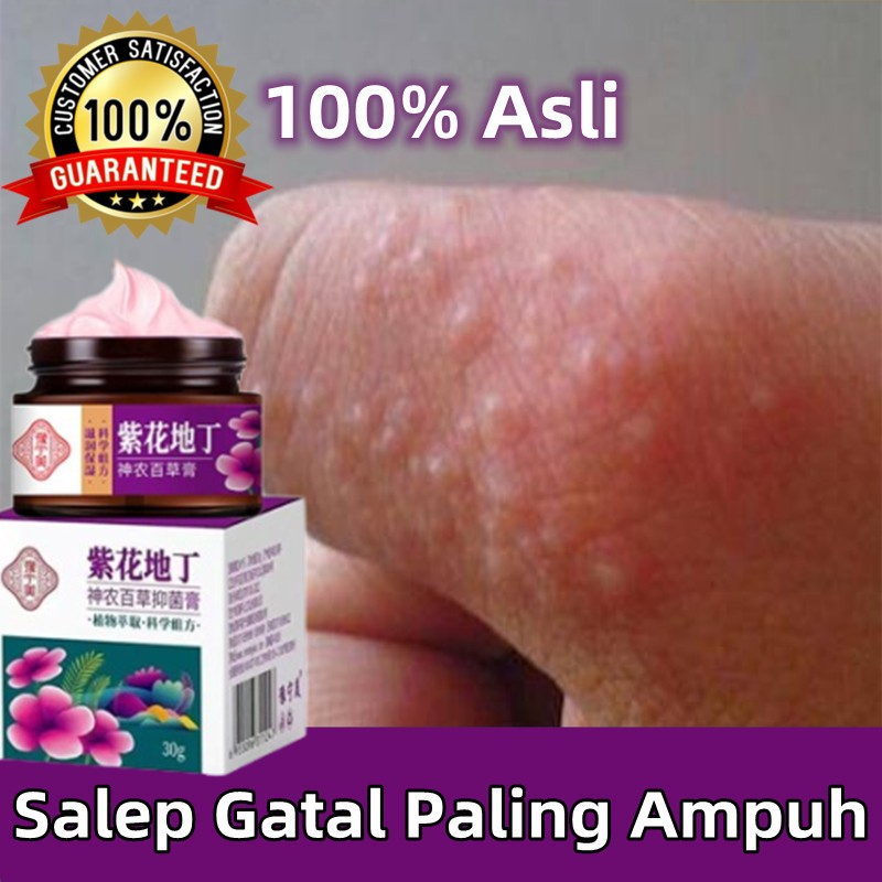 Jual salep gatal paling ampuh Anti jamur Salep salep gatal selangkangan ...