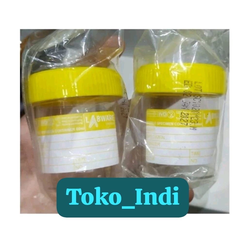 Jual Pot Urine Steril 60 ml Merk Labware Pot Tutup Kuning | Shopee ...