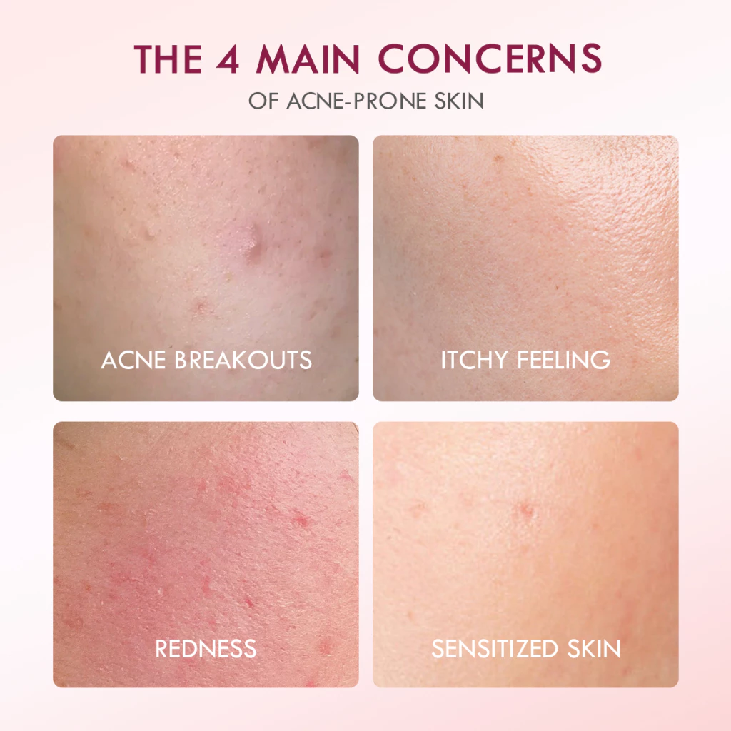Hyalucera Gel Pelembab Wajah dan Primer Menghidrasi Skin Barrier Originote