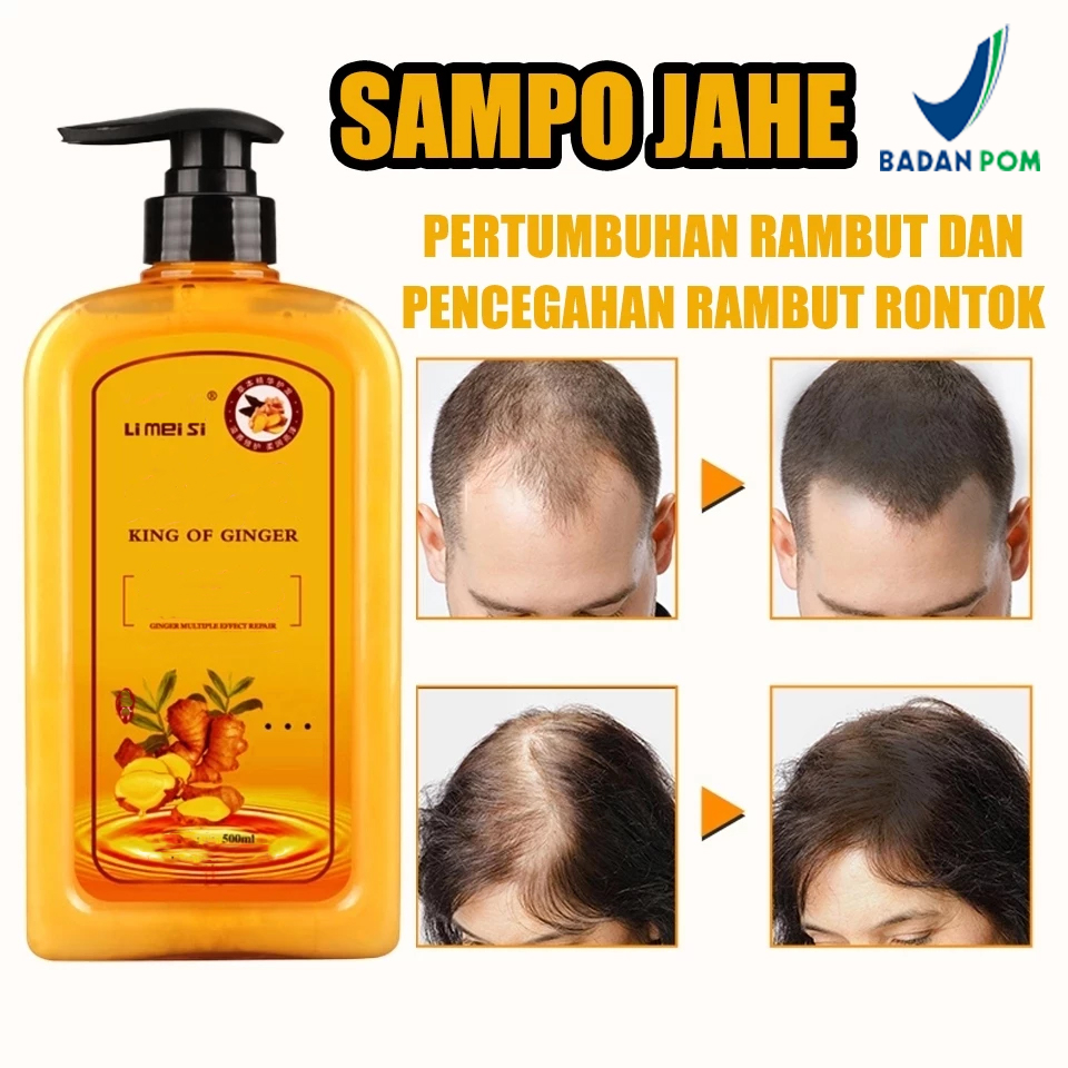 Jual 300ml Shampo Penumbuh Rambut Cepat Ginger Shampoo pertumbuhan ...