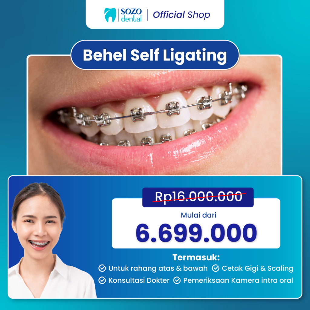 Jual Behel SELF LIGATING (Dokter Gigi Umum): Pemasangan Rahang Atas dan ...