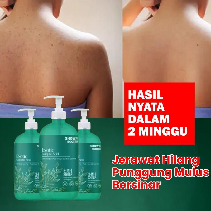 Jual Leeva Sabun Exotic Acne 250ml - Sabun Mandi Kulit Sensitif ...