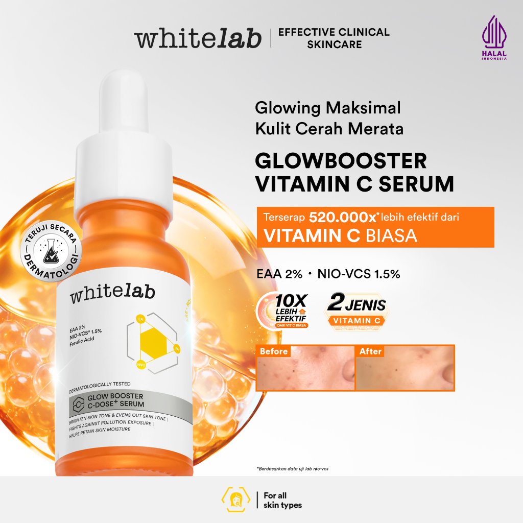Whitelab Serum Vitamin C Glow Booster - Antioksidan Tinggi untuk Kulit Cerah dan Glowing C-Dose+ dengan NIO-VCS