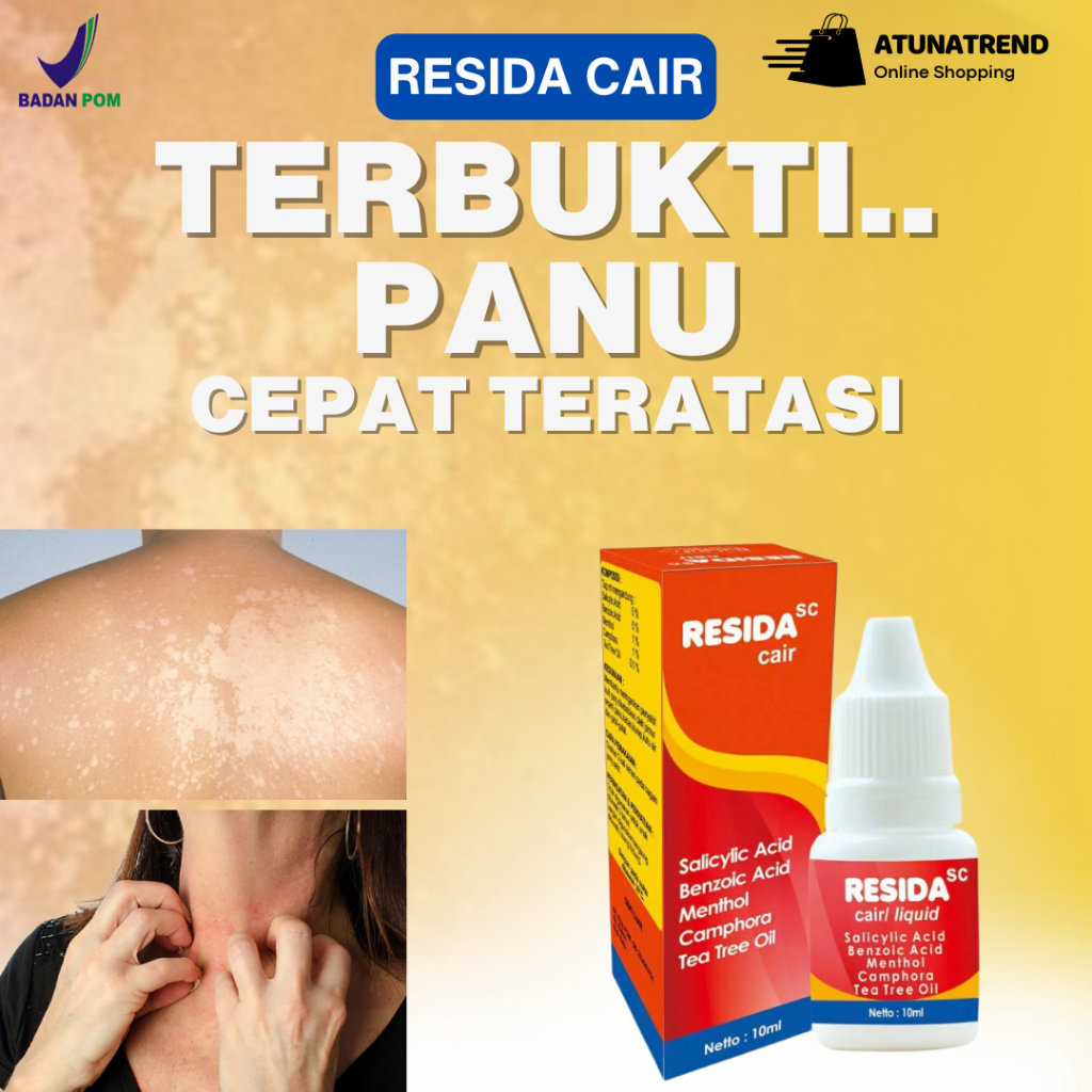 Jual 100% Bpom Penghilang Panu Di Badan Resida Cair Tetes Panuan Atasi ...
