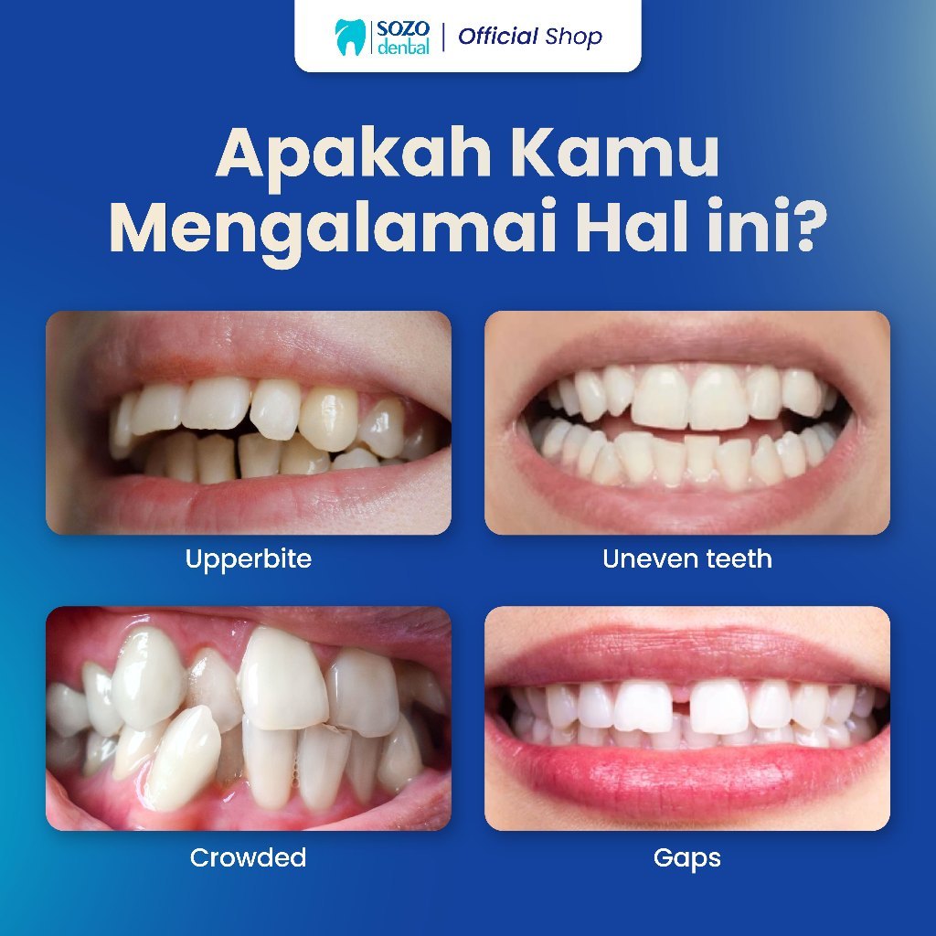 Jual Sozo Dental - Behel Metal Basic Rahang Atas dan Bawah, termasuk ...