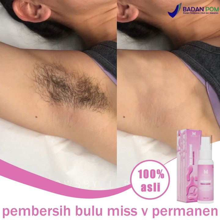 Pembersih bulu miss v permanen Cream penghilang bulu Hair removal cream miss v 2