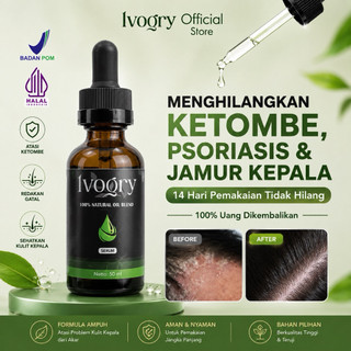 Serum Anti Ketombe BPO