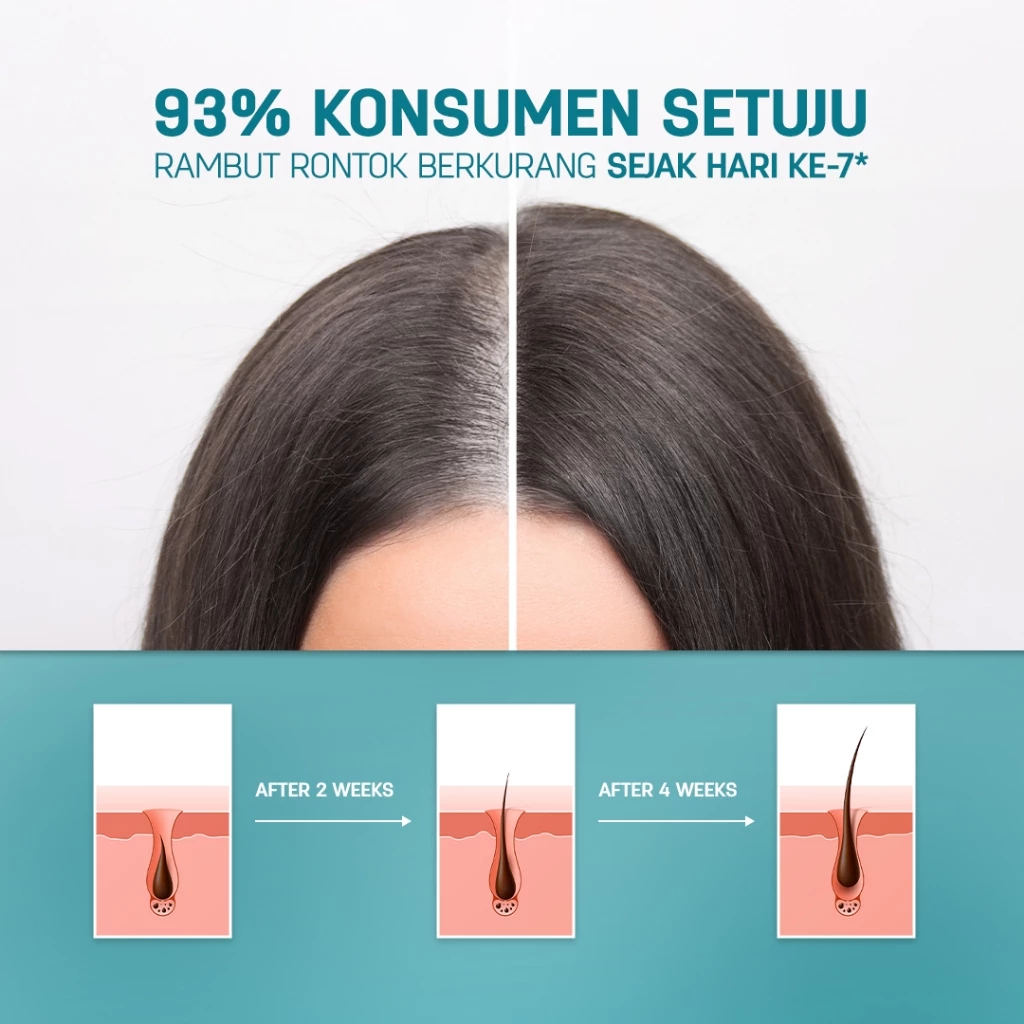 Jual [BEST SELLER TONIK RONTOK] ERHAIR HairGrow Tonic with Kopexil 60ml ...